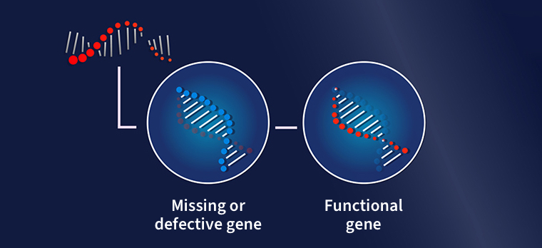 Gene Therapy and the Future of Eye Care - Retina Today